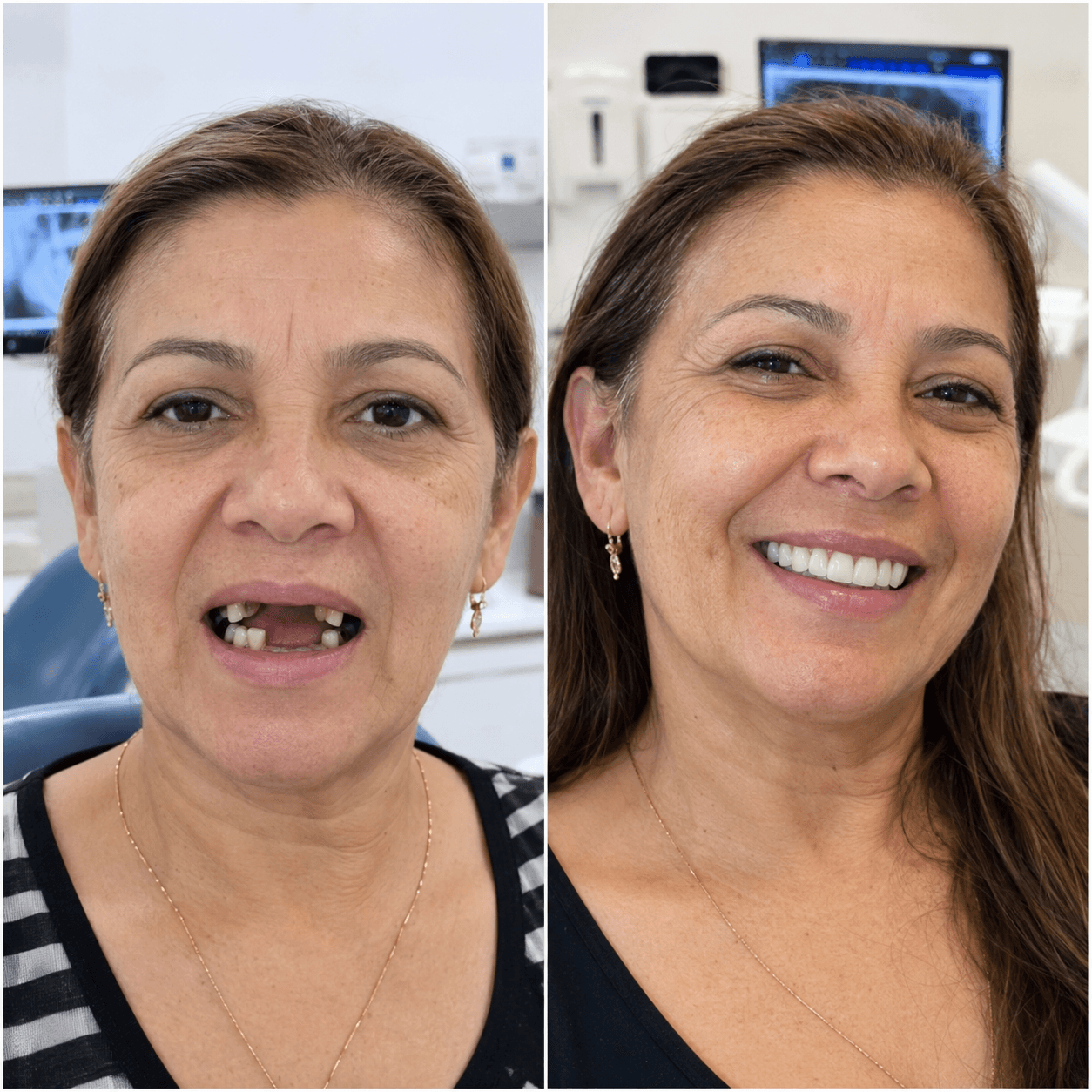 Clínica ViDental Zaragoza